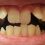 Kreivi dantys: kaip juos ištiesinti?