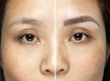 Microblading