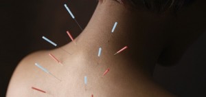 Per kančias į žvaigždes – alternatyvi medicina dar turi kuo nustebinti