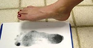 plokščiapėdystė - problema, dėl kurios reikėtų kreiptis pas ortopedą