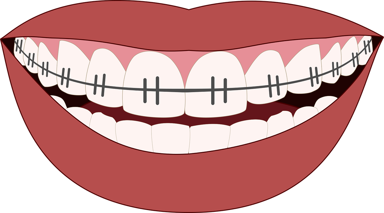 ortodontinis gydymas